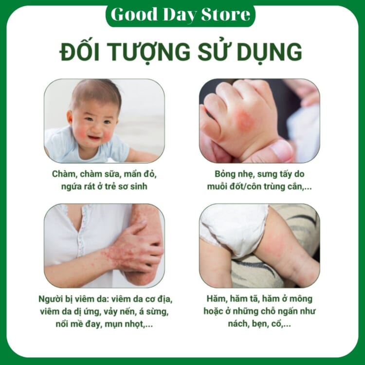 Kem bôi Viêm da cơ địa,dị ứng,á sừng,vảy nến,nổi mề đay,chàm sữa,hăm tã,Mabio Cream tuýp 15Gr